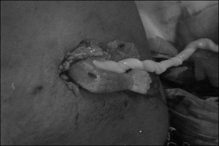 Plight of babies born and unborn